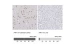 Immunohistochemistry analysis in human cerebral cortex and liver tissues using HPA031619 antibody. Corresponding ATN1 RNA-seq data are presented for the same tissues.