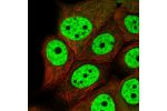 Immunofluorescent staining of human cell line MCF7 shows localization to nucleoplasm.