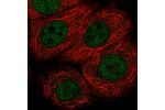 Immunofluorescent staining of human cell line MCF7 shows localization to nucleoplasm.