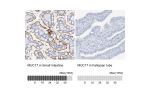 Immunohistochemistry analysis in human small intestine and fallopian tube tissues using HPA031634 antibody. Corresponding MUC17 RNA-seq data are presented for the same tissues.