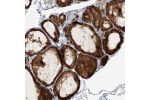 Immunohistochemical staining of human thyroid gland shows strong cytoplasmic positivity in glandular cells.