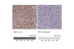 Immunohistochemistry analysis in human liver and pancreas tissues using HPA031642 antibody. Corresponding PAH RNA-seq data are presented for the same tissues.