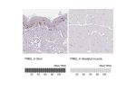 Immunohistochemistry analysis in human skin and skeletal muscle tissues using Anti-PMEL antibody. Corresponding PMEL RNA-seq data are presented for the same tissues.