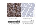Immunohistochemistry analysis in human smooth muscle and skeletal muscle tissues using Anti-MYLK antibody. Corresponding MYLK RNA-seq data are presented for the same tissues.
