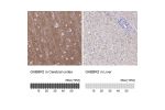 Immunohistochemistry analysis in human cerebral cortex and liver tissues using Anti-GABBR2 antibody. Corresponding GABBR2 RNA-seq data are presented for the same tissues.