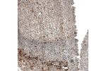 Immunohistochemical staining of human tonsil shows moderate to strong granular cytoplasmic positivity in non-germinal center and germinal center cells.