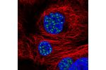 Immunofluorescent staining of human cell line A-431 shows localization to nuclear speckles.