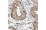 Immunohistochemical staining of human testis shows moderate nuclear and cytoplasm positivity in cells in seminiferous ducts.