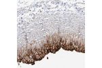 Immunohistochemical staining of human urinary bladder shows strong membranous positivity in urothelial cells.