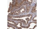 Immunohistochemical staining of human cervix, uterine shows strong cytoplasmic positivity in glandular cells.