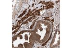 Immunohistochemical staining of human prostate shows strong cytoplasmic positivity in smooth muscles and glandular cells.
