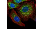 Immunofluorescent staining of human cell line A549 shows localization to nuclear membrane & vesicles.