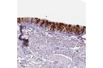 Immunohistochemical staining of human bronchus shows strong cytoplasmic positivity in respiratory epithelial cells.