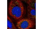 Immunofluorescent staining of human cell line A-431 shows localization to vesicles.