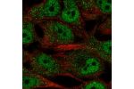 Immunofluorescent staining of human cell line SK-MEL-30 shows localization to nucleoplasm, mitochondria & vesicles.