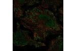Immunofluorescent staining of human cell line HeLa shows localization to nucleoplasm & vesicles.
