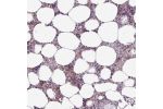 Immunohistochemical staining of human bone marrow shows positivity in hematopoietic cells.
