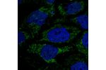 Immunofluorescent staining of human cell line CACO-2 shows localization to mitochondria.