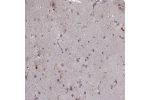 Immunohistochemical staining of human caudate shows strong cytoplasmic positivity in glial cells.