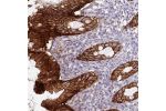 Immunohistochemical staining of human rectum shows strong cytoplasmic and membranous positivity in glandular cells.