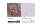 Immunohistochemistry analysis in human tonsil and skeletal muscle tissues using HPA032121 antibody. Corresponding CD37 RNA-seq data are presented for the same tissues.