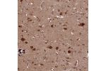 Immunohistochemical staining of human cerebral cortex shows strong cytoplasmic and nuclear positivity in neuronal cells.
