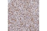 Immunohistochemical staining of human pancreas shows strong nuclear positivity in exocrine glandular cells.