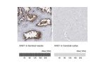 Immunohistochemistry analysis in human seminal vesicle and lymph node tissues using Anti-ANO1 antibody. Corresponding ANO1 RNA-seq data are presented for the same tissues.