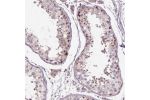 Immunohistochemical staining of human testis shows strong cytoplasmic positivity in spermatogonia.
