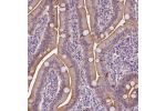 Immunohistochemical staining of human small intestine shows membranous positivity in glandular cells.