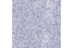 Immunohistochemical staining of human pancreas shows no positivity in exocrine glandular cells as expected.