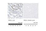 Immunohistochemistry analysis in human lung and skeletal muscle tissues using HPA034532 antibody. Corresponding MNDA RNA-seq data are presented for the same tissues.