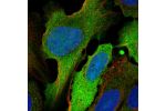Immunofluorescent staining of human cell line U-2 OS shows localization to plasma membrane & cytosol.