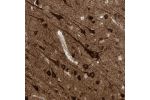 Immunohistochemical staining of human cerebral cortex shows strong cytoplasmic positivity in neurons.