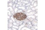 Immunohistochemical staining of human kidney shows strong membranous positivity in cells in glomeruli.