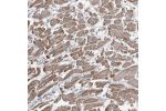 Immunohistochemical staining of human heart muscle shows moderate cytoplasmic positivity in myocytes.