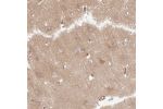 Immunohistochemical staining of human Cerebral cortex shows weak cytoplasmic positivity in neuronal cells.