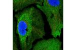 Immunofluorescent staining of human cell line HeLa shows localization to plasma membrane & cytosol.