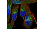 Immunofluorescent staining of human cell line RH-30 shows localization to vesicles.
