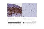 Immunohistochemistry analysis in human tonsil and cerebral cortex tissues using Anti-TXNDC5 antibody. Corresponding TXNDC5 RNA-seq data are presented for the same tissues.