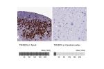 Immunohistochemistry analysis in human tonsil and cerebral cortex tissues using Anti-TXNDC5 antibody. Corresponding TXNDC5 RNA-seq data are presented for the same tissues.
