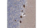 Immunohistochemical staining of human cerebellum shows strong cytoplasmic positivity in Purkinje cells.
