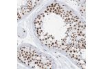 Immunohistochemical staining of human testis shows strong nuclear positivity in cells in seminiferous ducts.