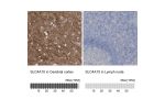 Immunohistochemistry analysis in human cerebral cortex and lymph node tissues using HPA034755 antibody. Corresponding SLC4A10 RNA-seq data are presented for the same tissues.