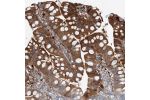Immunohistochemical staining of human small intestine shows cytoplasmic positivity in glandular cells.