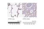 Immunohistochemistry analysis in human lung and kidney tissues using Anti-SFTPB antibody. Corresponding SFTPB RNA-seq data are presented for the same tissues.