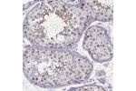 Immunohistochemical staining of human testis shows moderate nuclear and cytoplasmic positivity in cells in seminiferous ducts.