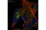 Immunofluorescent staining of human cell line RH-30 shows localization to the Golgi apparatus.