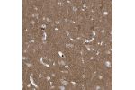 Immunohistochemical staining of human cerebral cortex shows moderate positivity in neuropil.