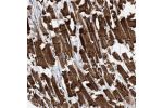 Immunohistochemical staining of human heart muscle shows strong cytoplasmic and membranous positivity in myocytes.